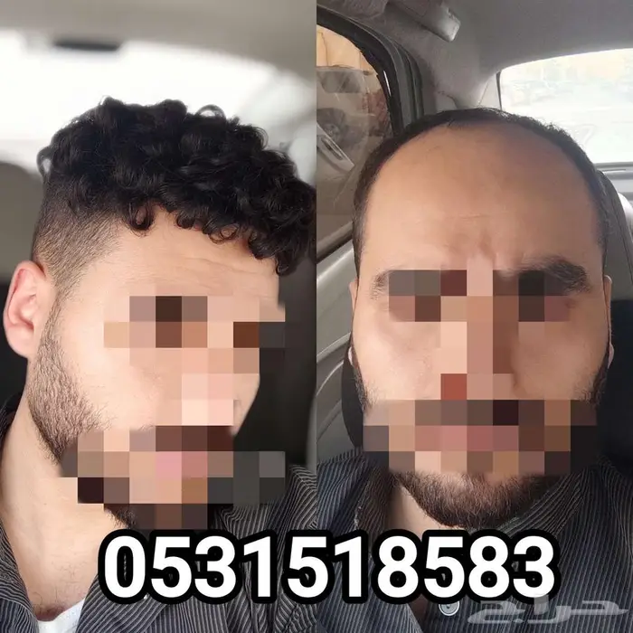 باروكة لصق دائمه 1