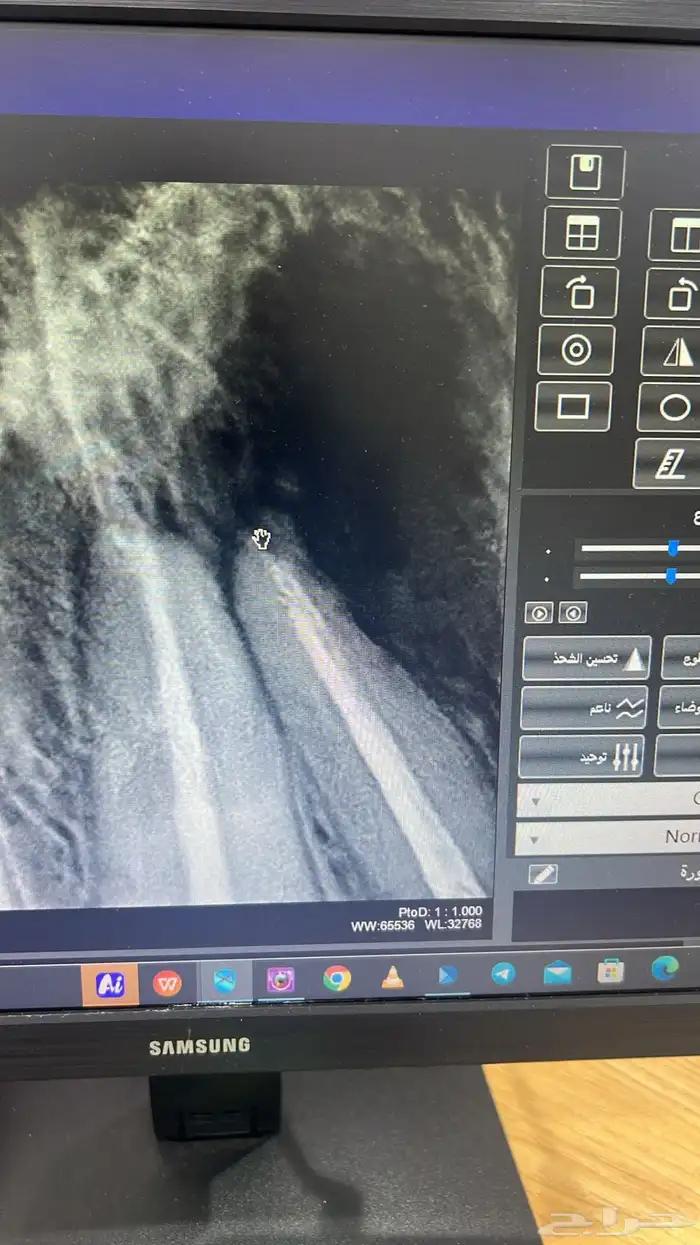 فلم اشعة سنيه (سنسور ) عرض خاص وحصري 2 سينسور ب 4800 2