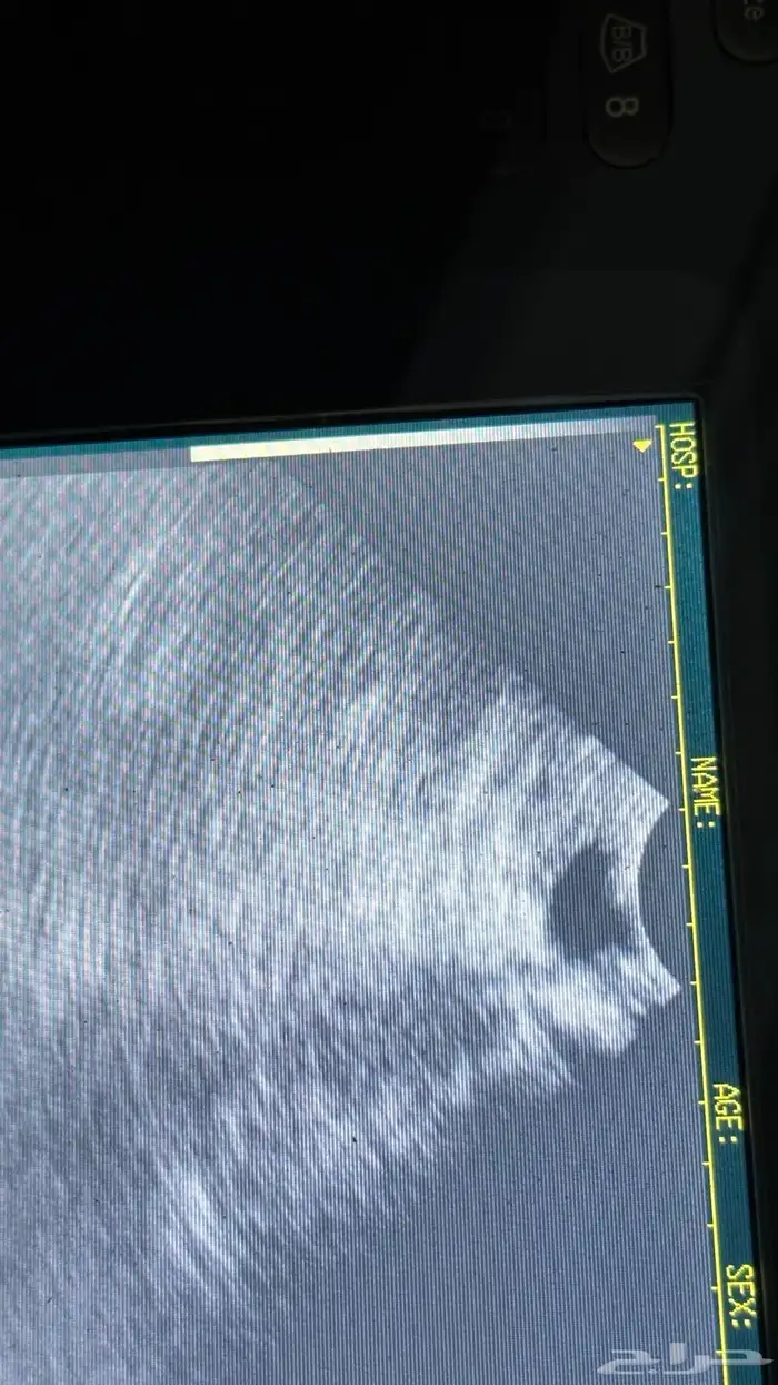 فحص سونار للاغنام و الماعز والخيل 2