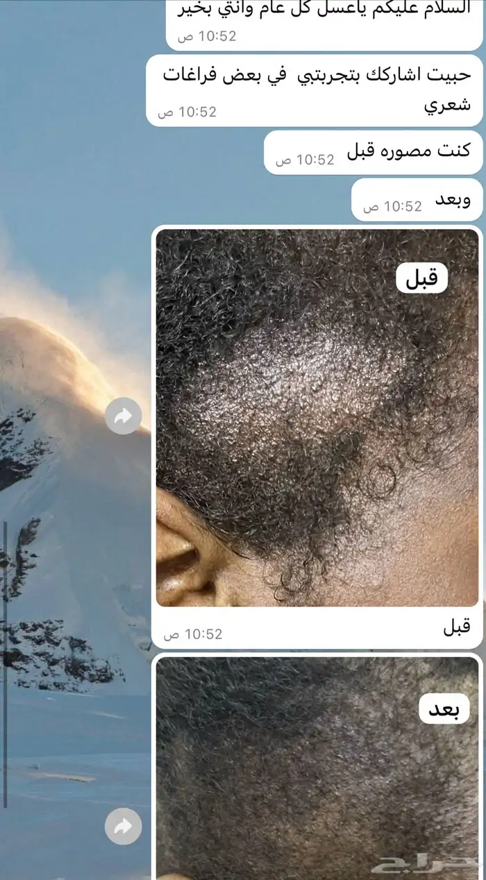 زيت افغاني  زيت مشاط 0