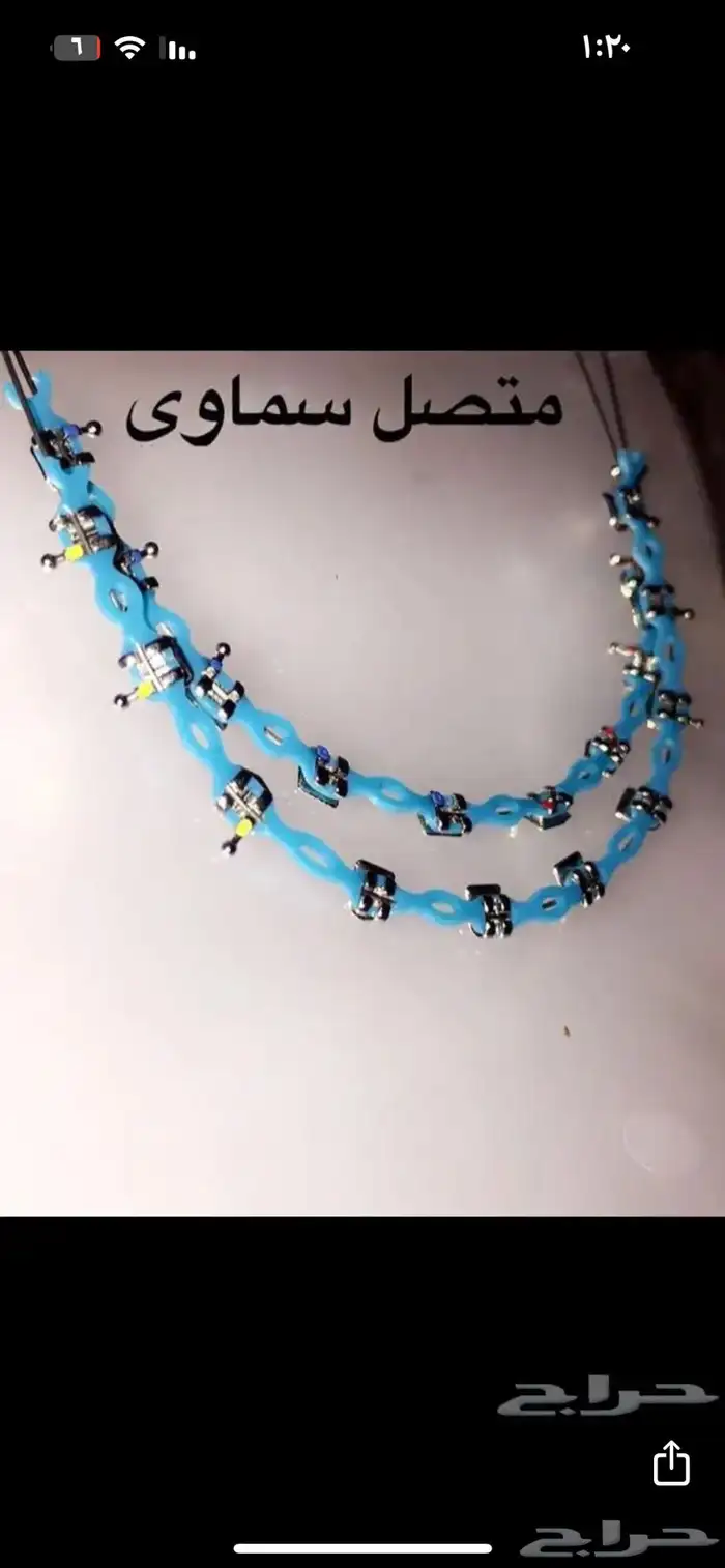 تقويم اسنان زينه 7