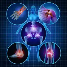 تدريس طب جراحة عظام 0