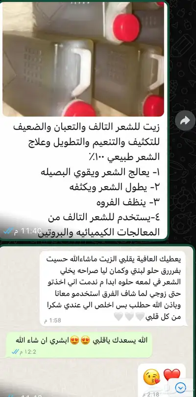 زيت شعر طبعي معمول بذمه انه مايعدم الشعر ويطول وينعم ويزيل 0