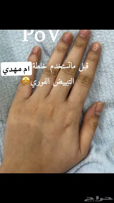 حياكم سمن وحوامض وخلطه تبييض وعليها ضمان ذهبي 3