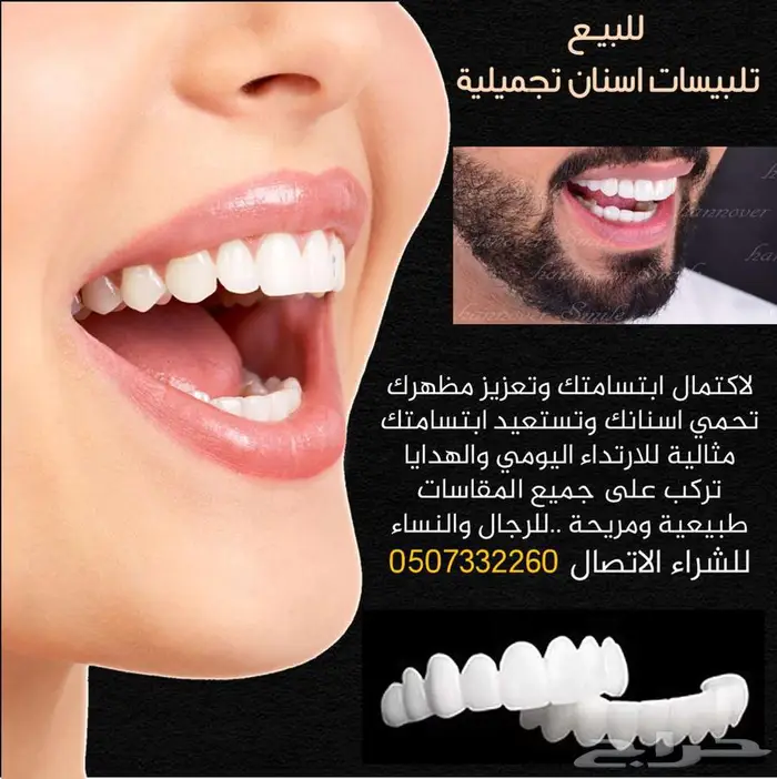 للبيع تلبيسات اسنان تجميلية 0