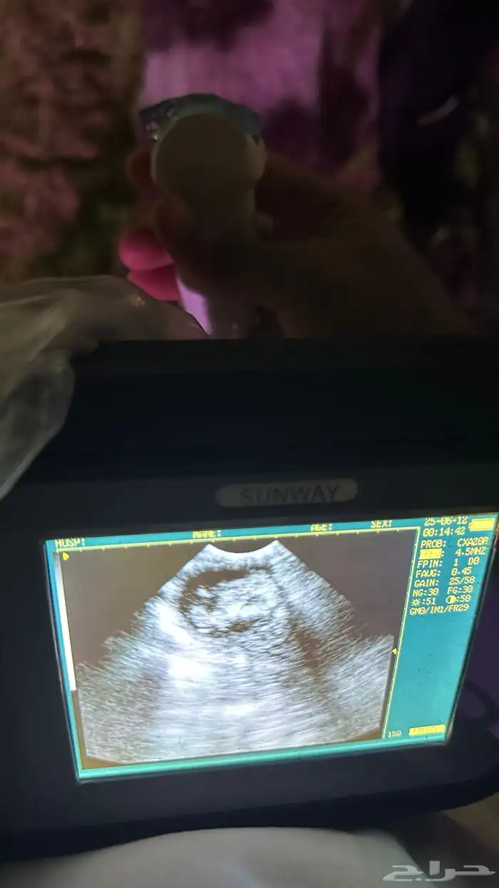 فحص سونار للاغنام والماعز وللأبقار وللخيل والابل 7