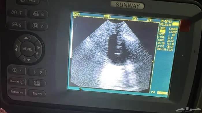 فحص سونار للاغنام والماعز وللأبقار وللخيل والابل 6