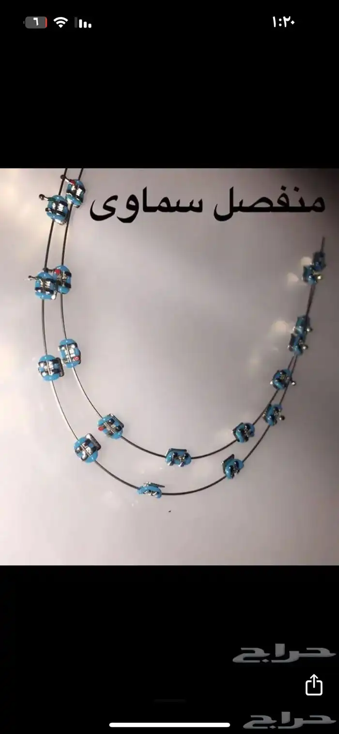 تقويم اسنان 4