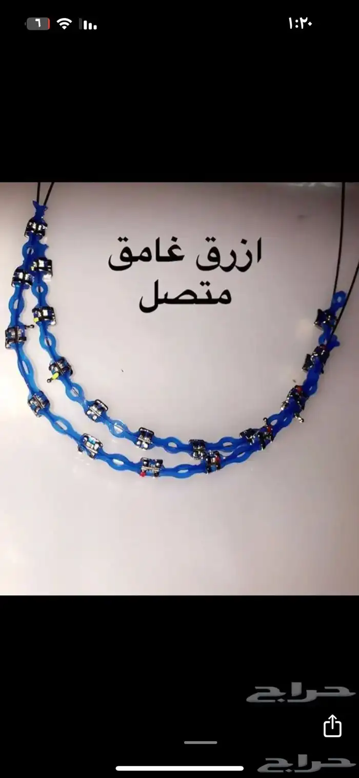 تقويم اسنان 1
