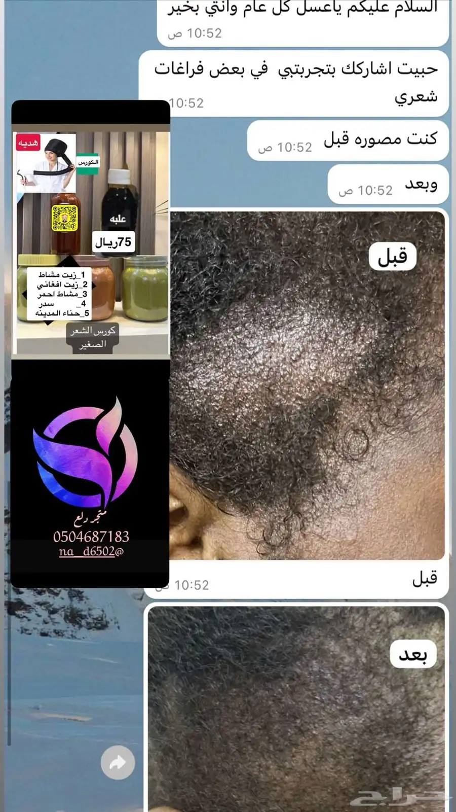 زيت مشاط  زيت افغاني 11