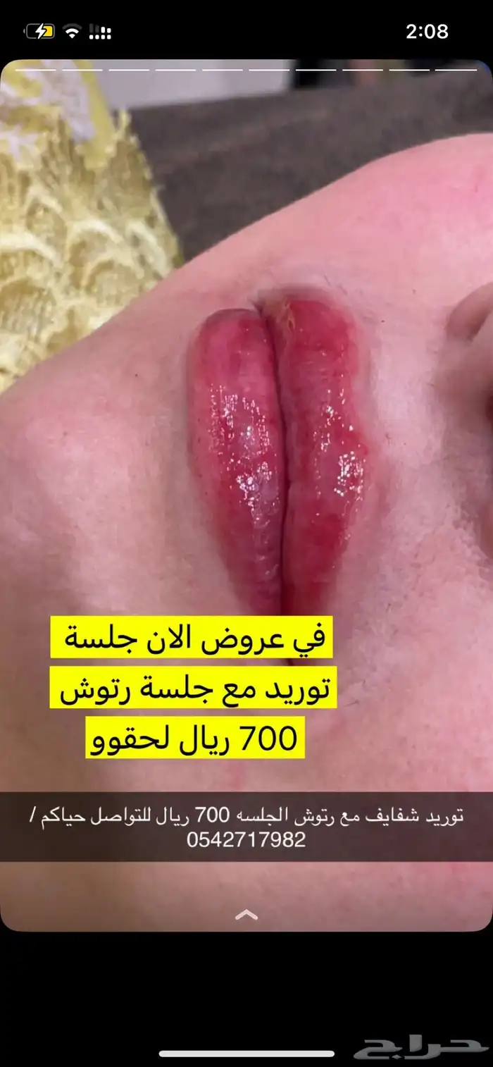 توريد شفايف 0