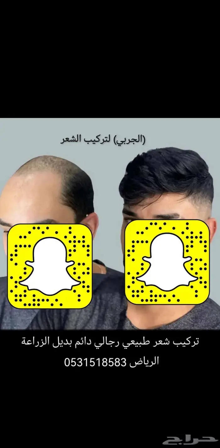 بروكة لصق رجالي دائمه 1