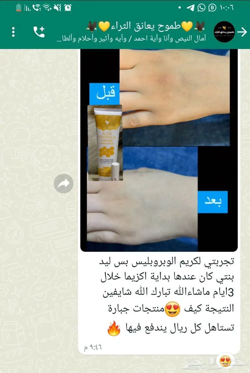 البيع الاكزيما 6