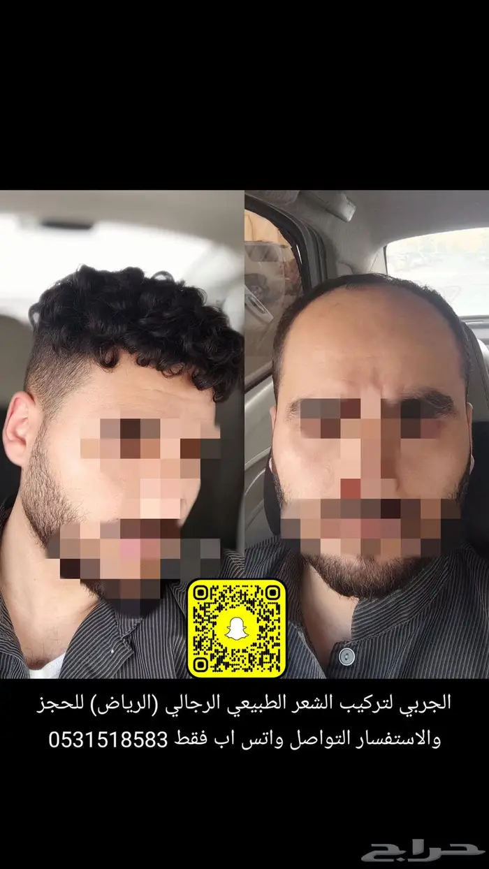 تركيب شعر دائم رجالي طبيعي بشري 0