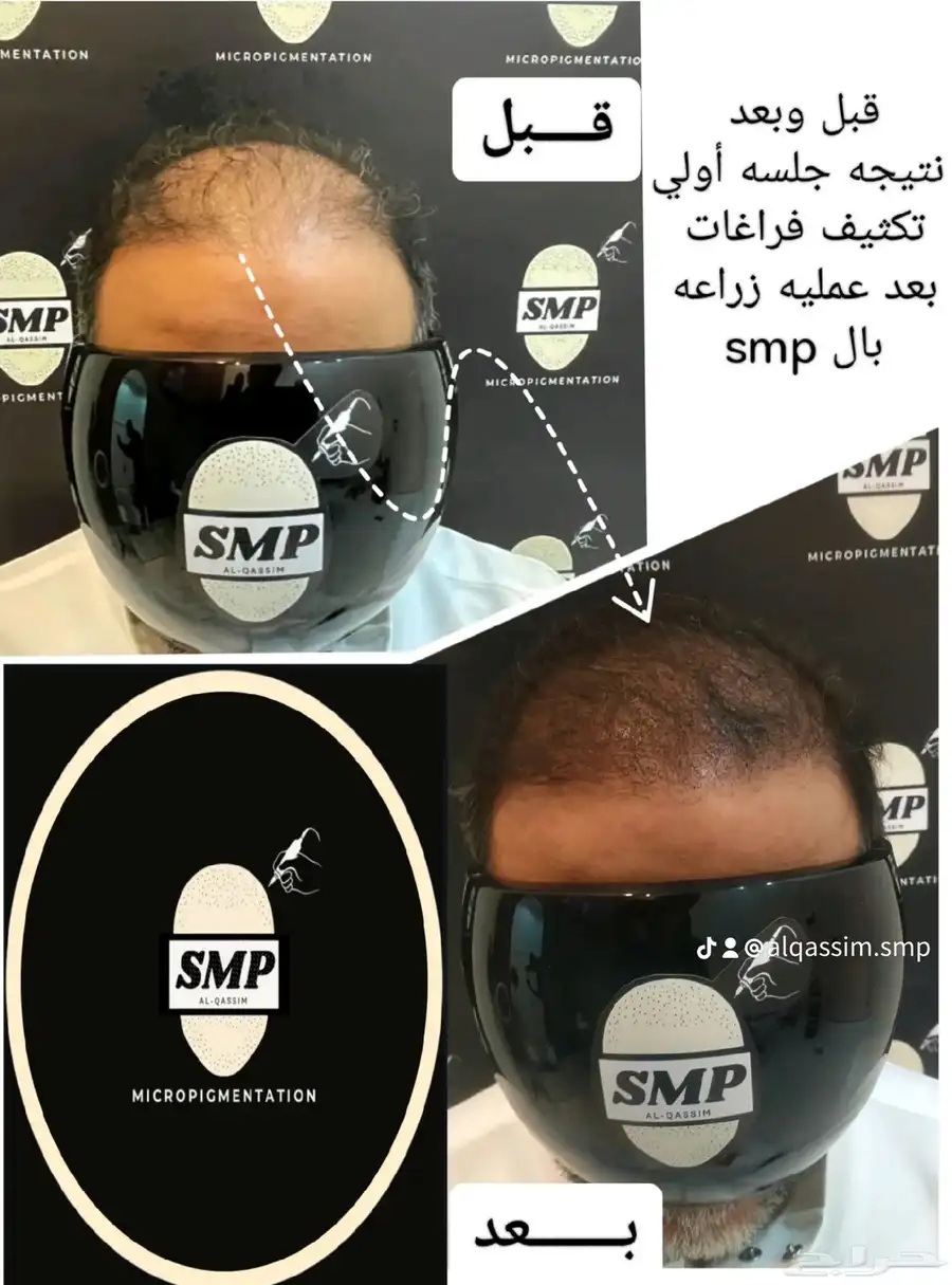 تقنية smp 0
