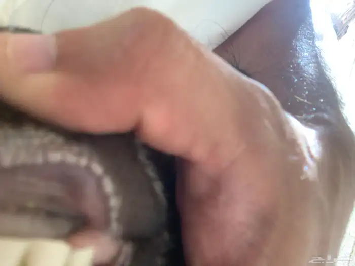 معزا عوارض 5