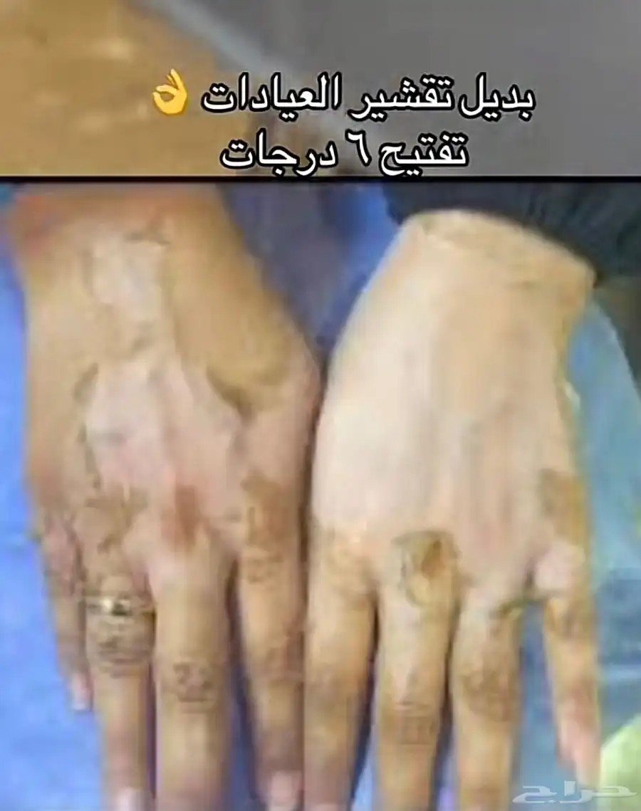 كريم تفتيح البشرة 0