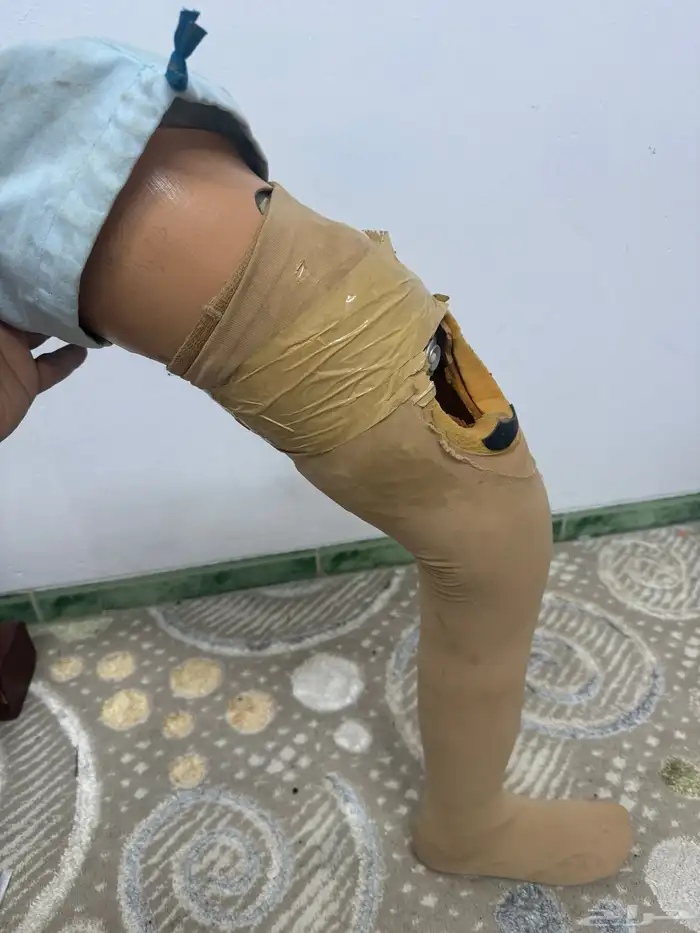 طرف صناعي رجل فوق الركبه 2
