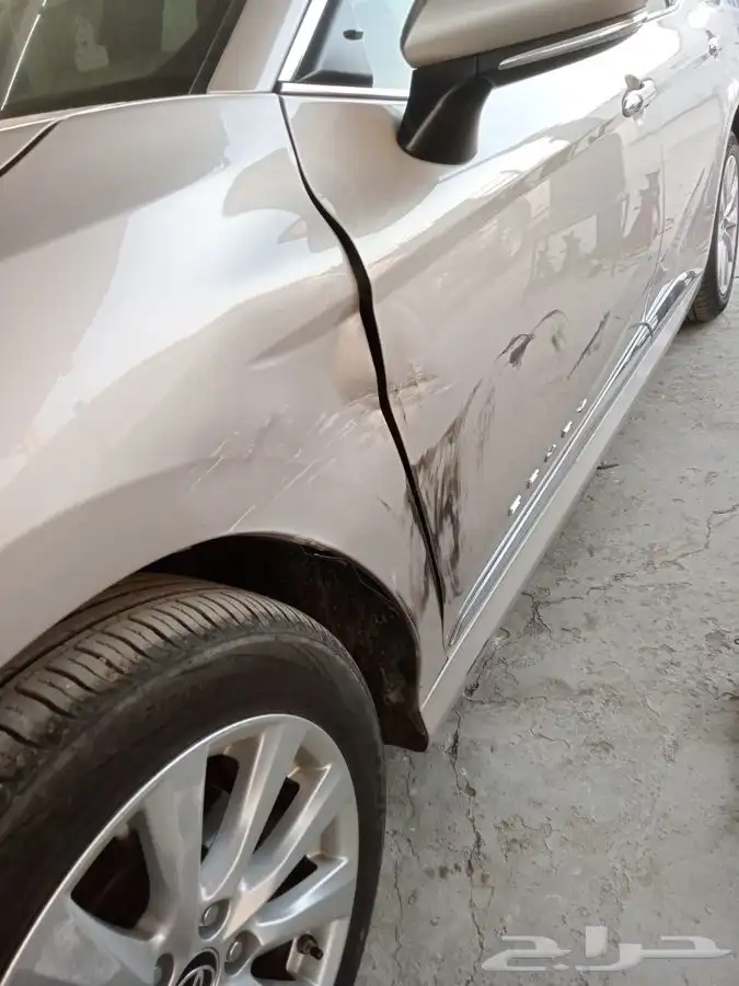 شفط وتعديل الصدمات بدون رش بويه 6