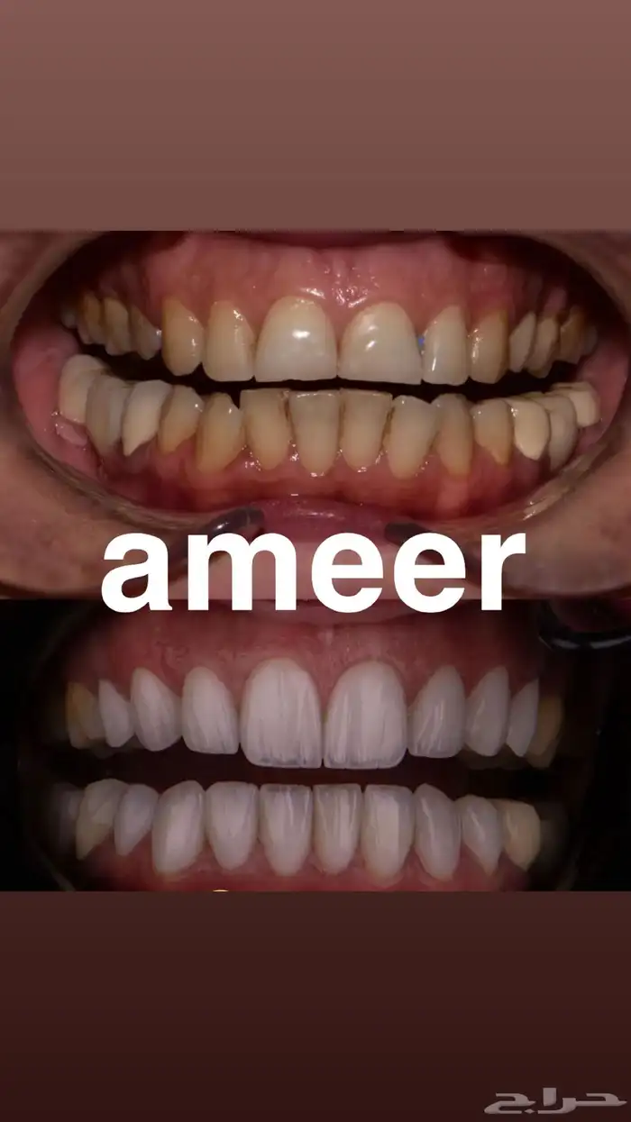 عيادة اسنان بالخبر 4