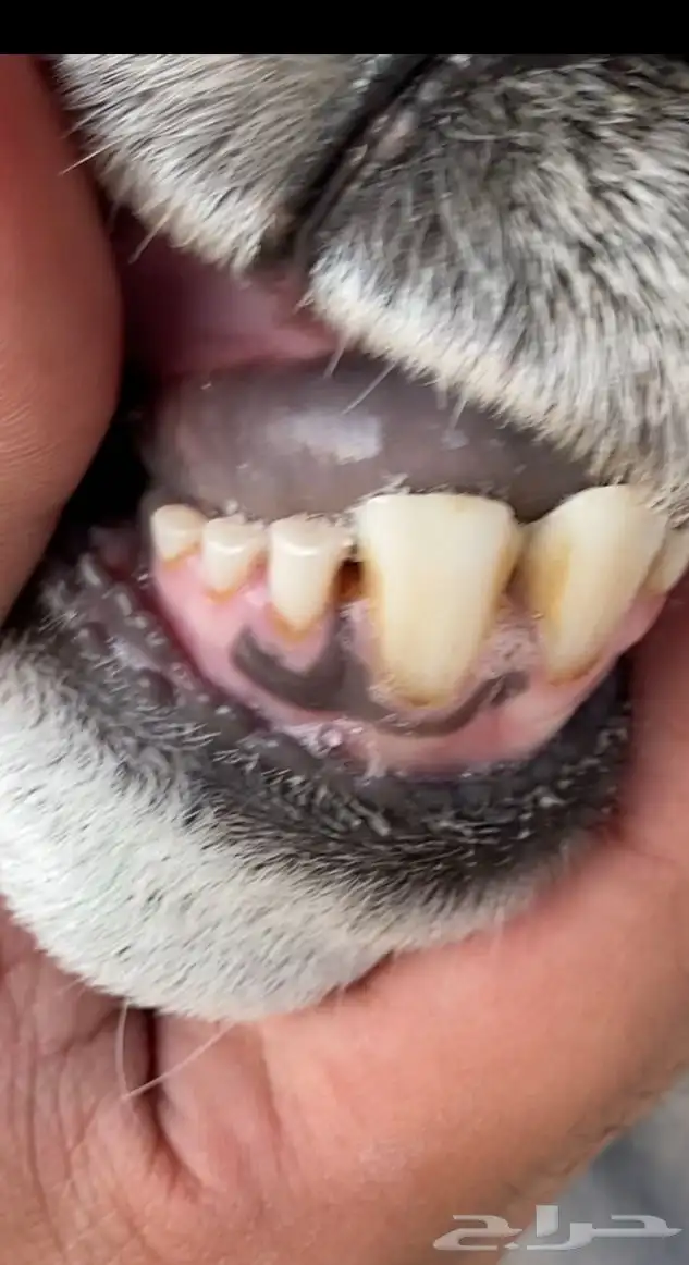 حريه ثنيه دافع شرط 2