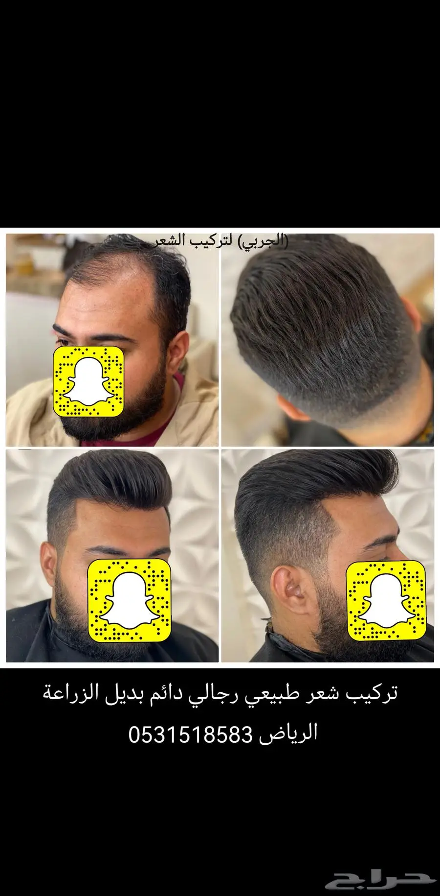 باروكة شعر رجالي لصق 1