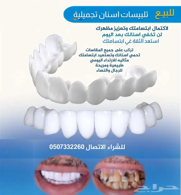للبيع تلبيسات اسنان تجميلية 0
