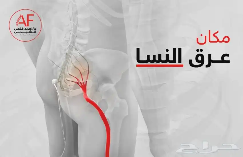 معالج شعبي لي علاج الابهر وعرق النساء والانزلاق الغظروفي 0