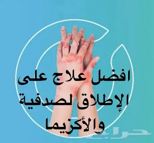 افضل علاج على إلا طلاق لصدفية والاكزيما 0