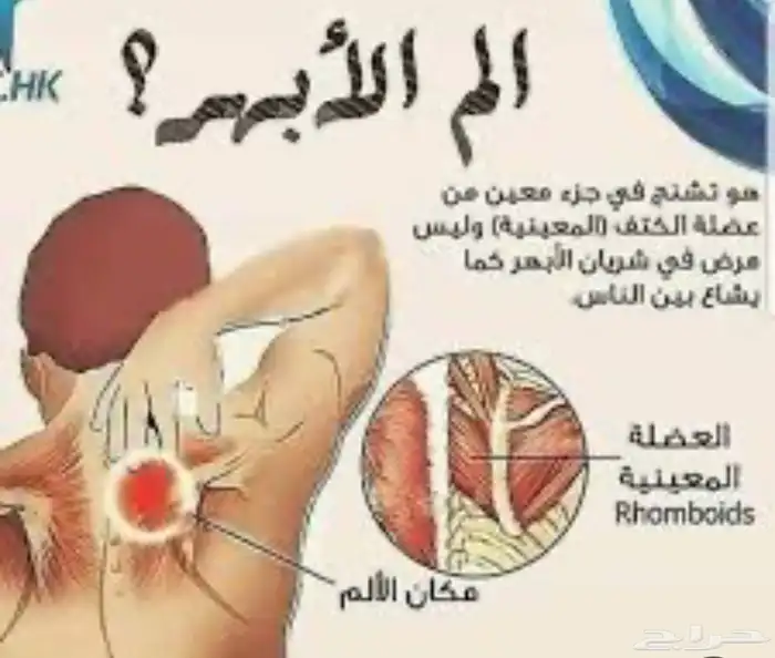 حجامة طبيه وفك الأبهر للجنسين 0