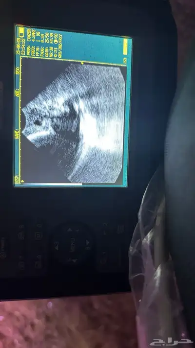 فحص سونار للخيل و الغنم والماعز والبقر في الشرقية 2