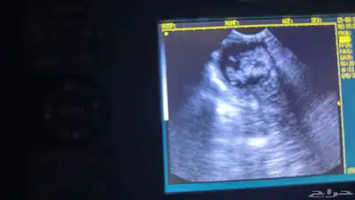 فحص سونار للخيل و الغنم والماعز والبقر في الشرقية 9