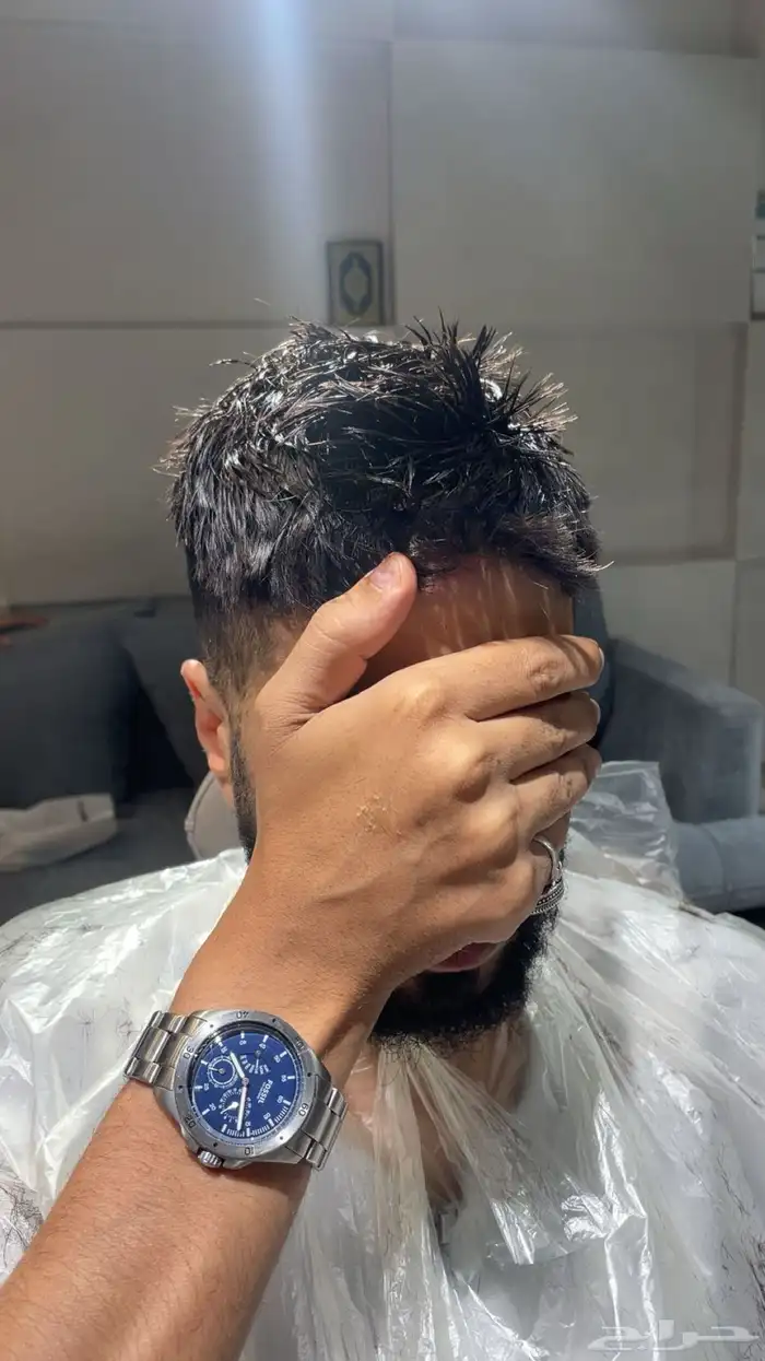 تركيب شبكيات شعر طبيعي بجوده عاليه من غير زراعه وعمليات 7