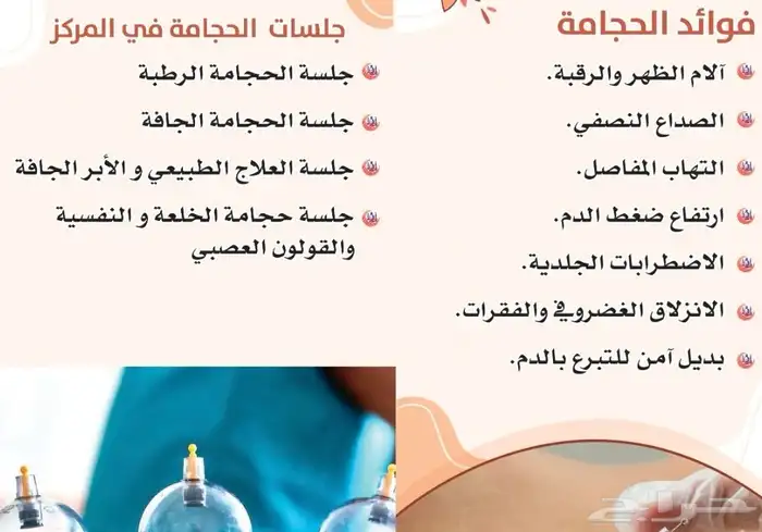 أخصائي الحجامة الرطبة والجافه 0