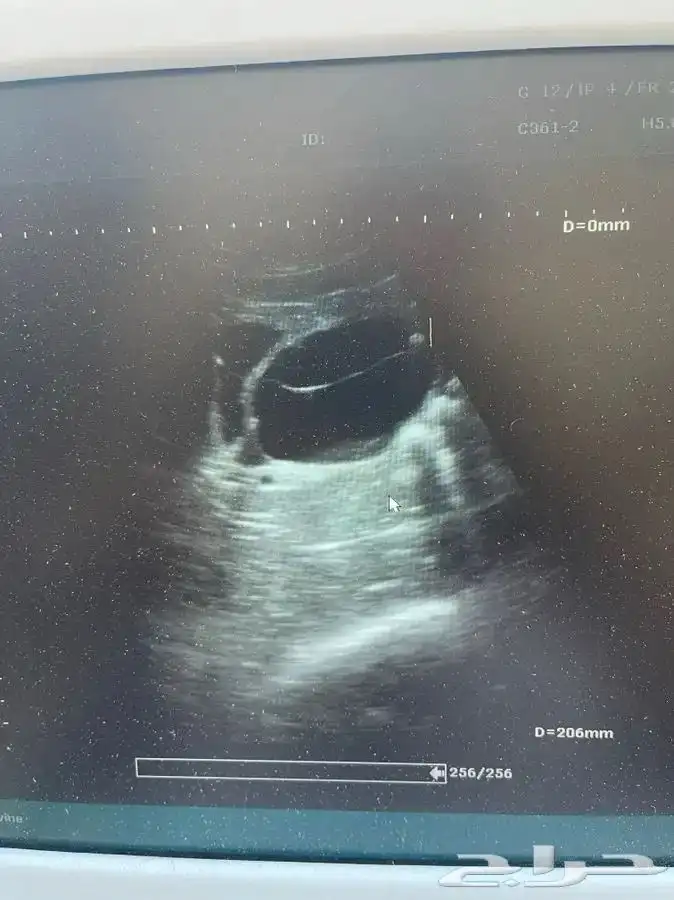 طبيب بيطري لفحص الاغنام عن طريق السونار 1