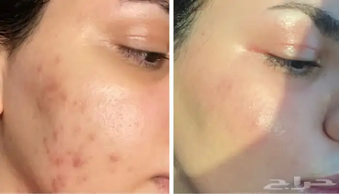 جمال بشرتك يبدأ من هنا  منتجات التجميل 3