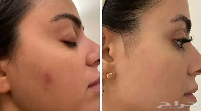 جمال بشرتك يبدأ من هنا  منتجات التجميل 2