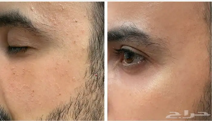 جمال بشرتك يبدأ من هنا  منتجات التجميل 4