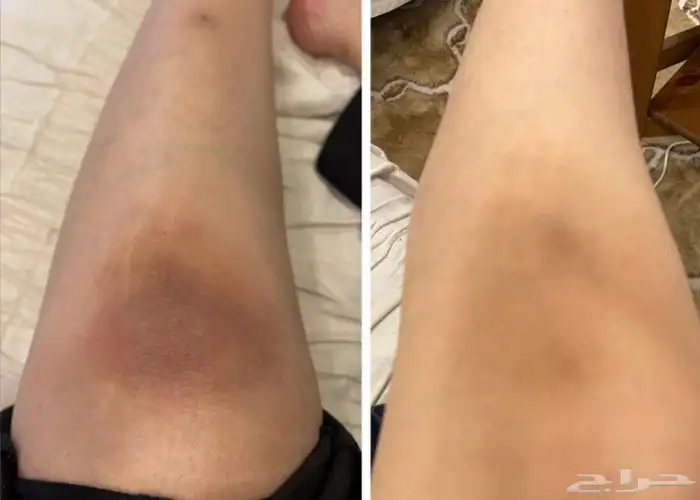 جمال بشرتك يبدأ من هنا  منتجات التجميل 6