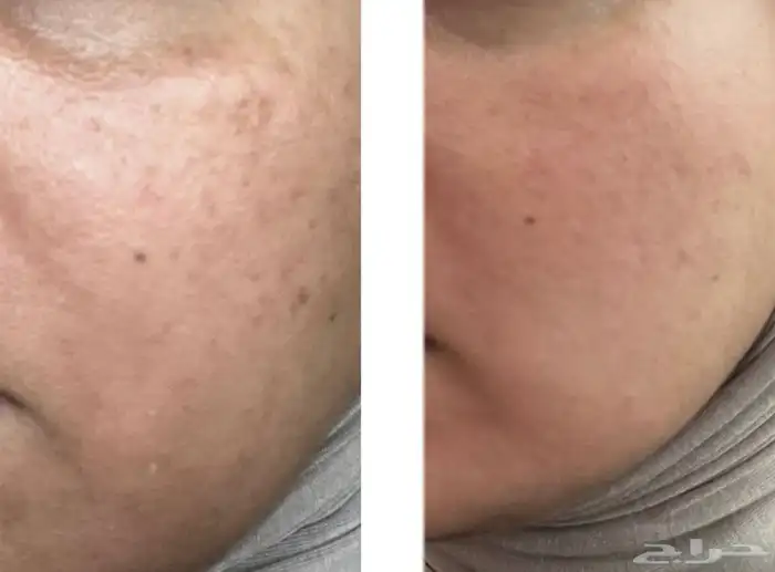 جمال بشرتك يبدأ من هنا  منتجات التجميل 1