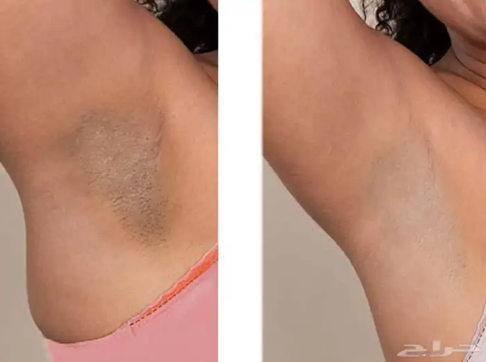جمال بشرتك يبدأ من هنا  منتجات التجميل 5