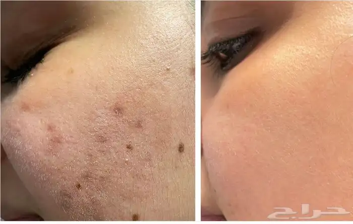 جمال بشرتك يبدأ من هنا  منتجات التجميل 0