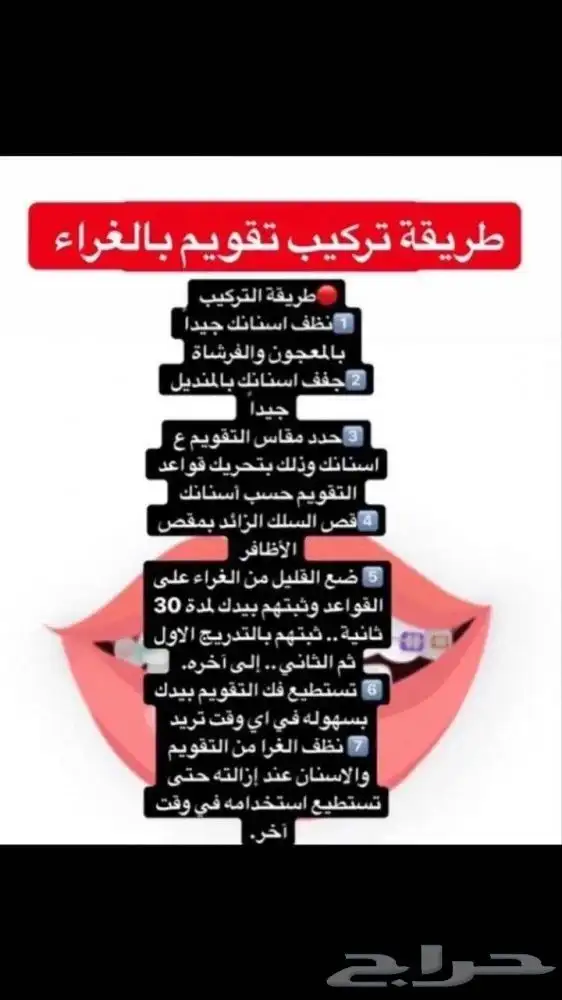 تقويم اسنان زينه 14