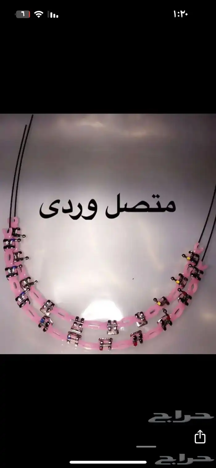 تقويم اسنان زينة 8