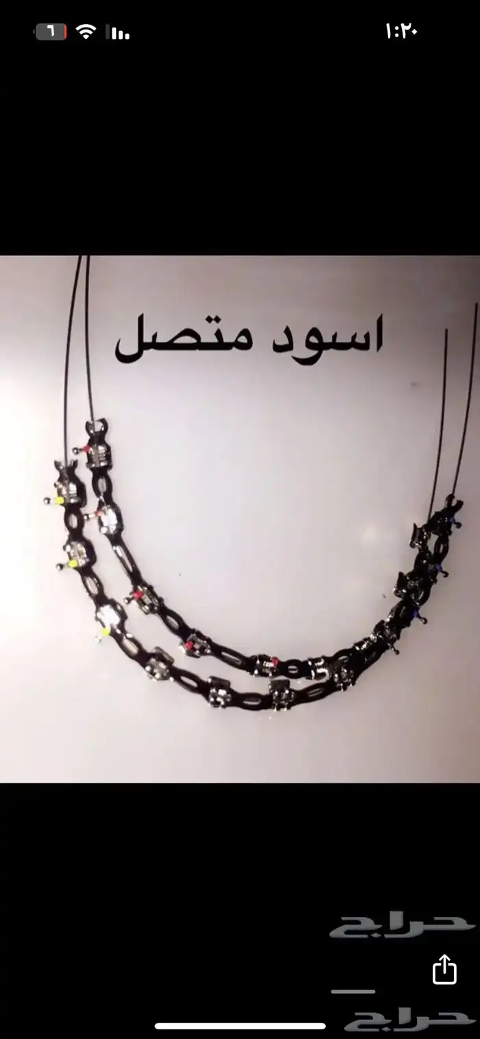 تقويم اسنان زينة 9