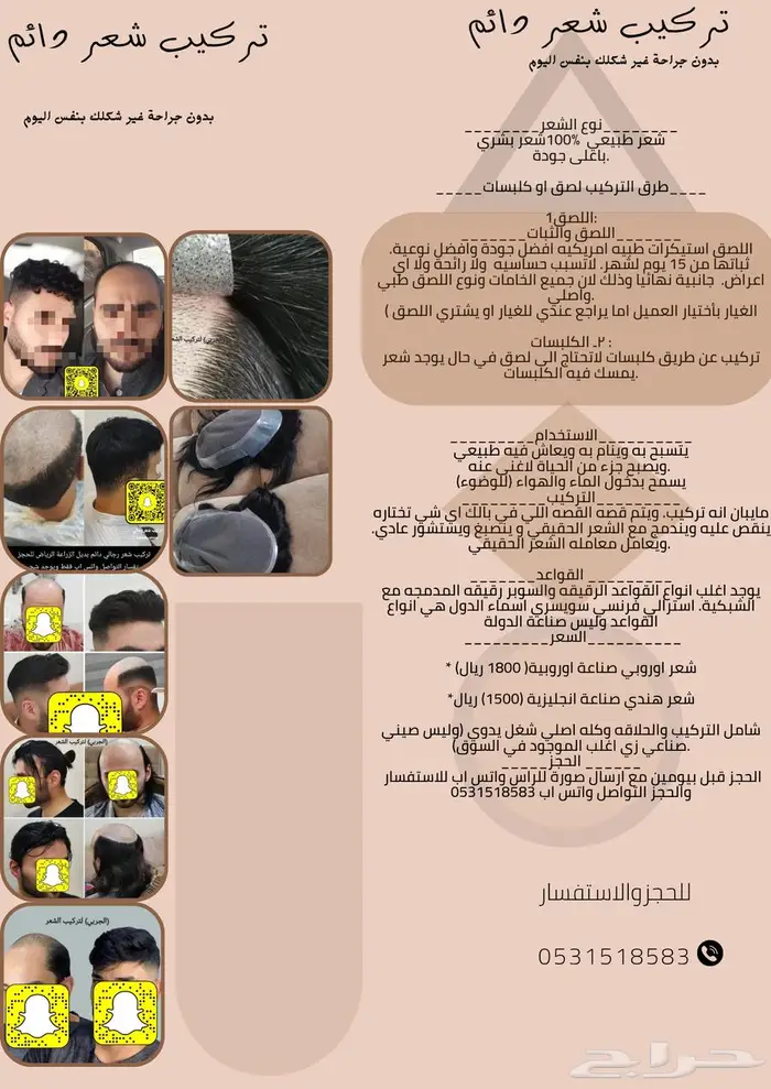 بوستيجه تركيب شعر 0