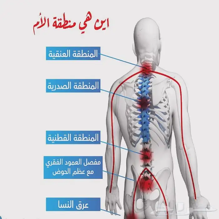 معالج شعبي لي علاج الابهر وعرق النساء والانزلاق العظروفي 0
