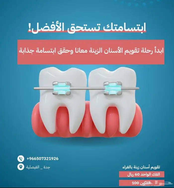 تقويم أسنان 0