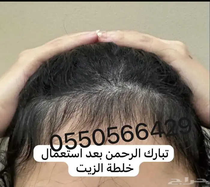 ز ي  ت للشعر طبيعي 100 5