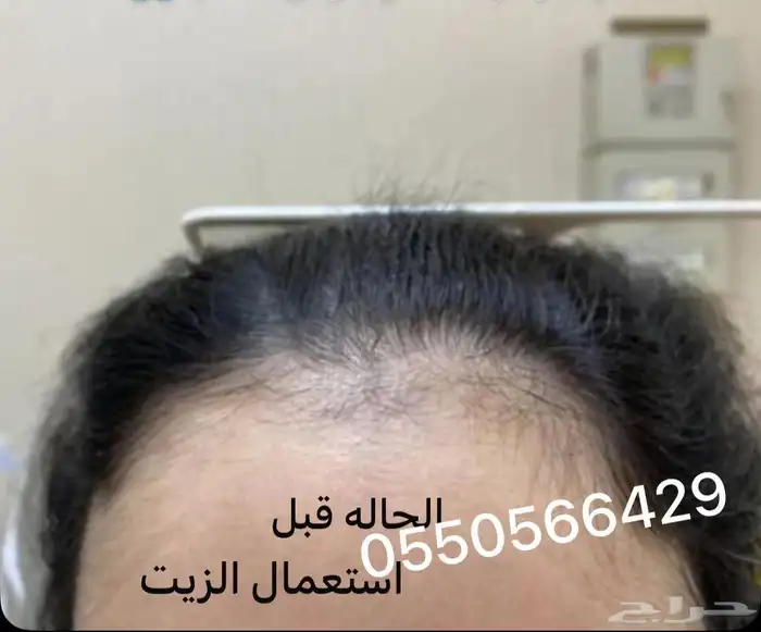 ز ي  ت للشعر طبيعي 100 4
